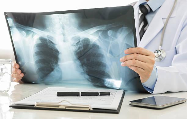 Doctor examining a lung radiography at hospital
