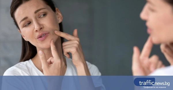 Домашен метод с сода и пара за премахване на черни точки